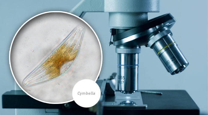 Photo prise au microscope de l’algue Cymbella 