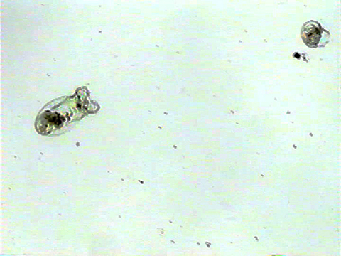 Vidéo filmée au microscope montrant Asplanchna 