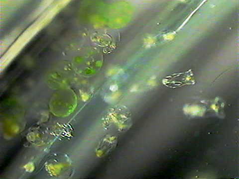 Vidéo filmée au microscope montrant des rotifères.