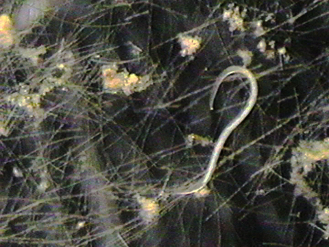 Video filmed under a microscope of a nematod